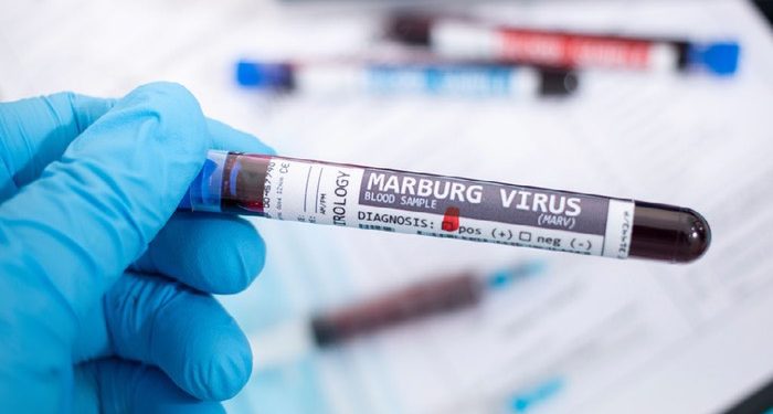 Abantu bashya banduye Marburg mu Rwanda n'abayikize barangana